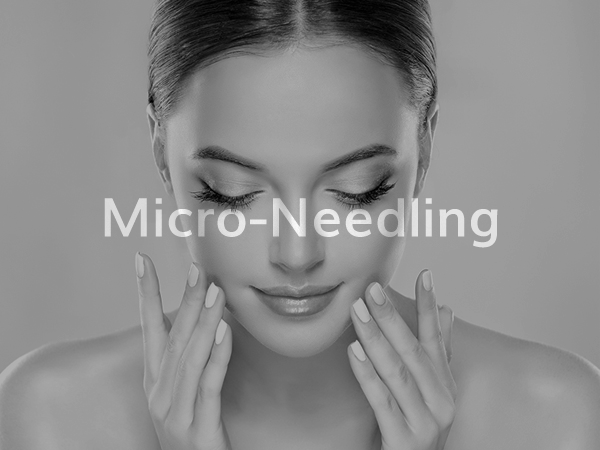 Micro Needling 2